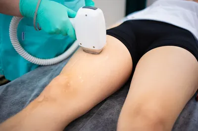 Estetic Body - Elektroepilacja (elektroliza igłowa), depilacja laserowa, masaż rolerowy Endosfera